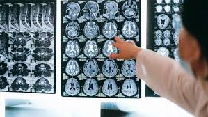Neuro Rehabilitation
